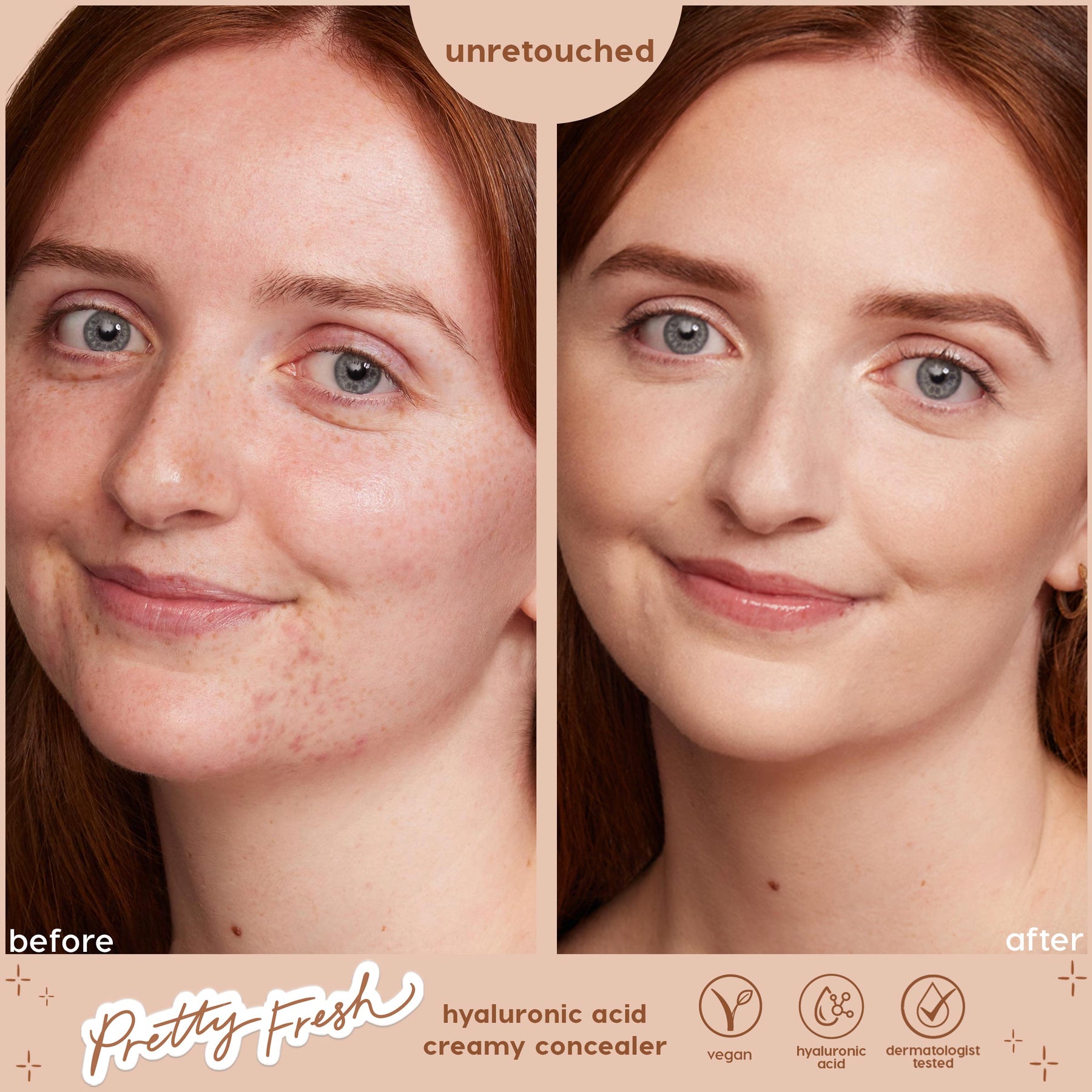 Fair 10 N - Pearlescent Portable Complexion Story